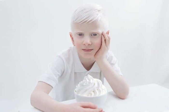 porcelain beauty albinism yulia taits 12 e1563360496431